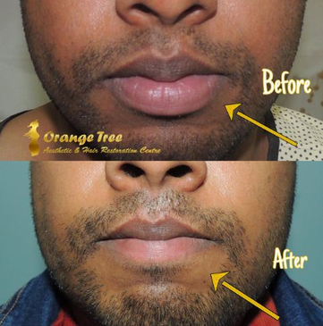 Slider image (2) Orange Tree Aesthetic And Hair Restoration Centre